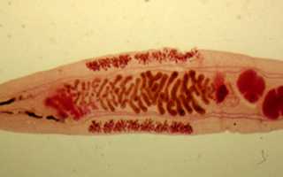 Кошачий сосальщик: жизненный цикл, строение и чем он опасен