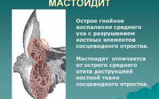 Левосторонний мастоидит характеристика симптомы лечение прогноз