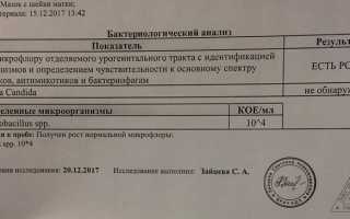 Анализ на посев: что это и как он проводится