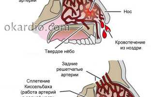 Передняя тампонада носа