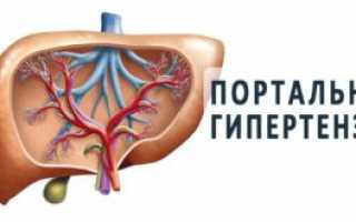 Синдром портальной гипертензии — лечение и профилактика