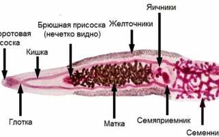 Клонорхоз: причины возникновения, симптомы и лечение