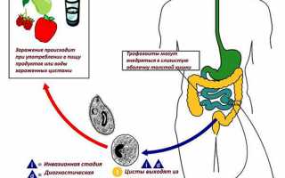 Балантидий: жизненный цикл, симптомы и лечение