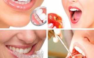 Как проходит лечение каппами Invisalign