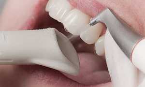 Почему болят передние нижние и верхние зубы