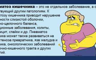 Пневматизация кишечника