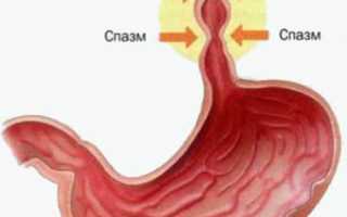 Симптомы и лечение спазмов пищевода