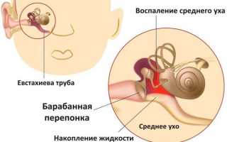 Диоксидин инструкция по применению, аналоги и отзывы