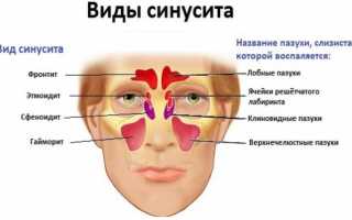 Список капель от синусита и рекомендации к применению