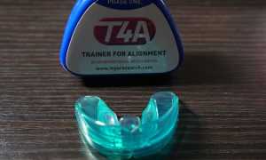Трейнер для зубов: что это такое и как правильно носить