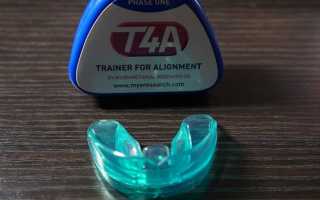 Трейнер для зубов: что это такое и как правильно носить