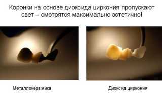 Виды зубных коронок