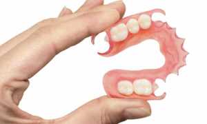 Современные методы протезирования зубов: технологии и виды