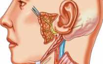 Симптомы и лечение воспаления слухового нерва