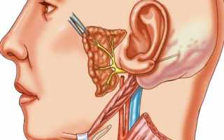 Симптомы и лечение воспаления слухового нерва
