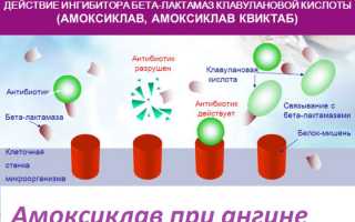 Может ли быть ангина без температуры