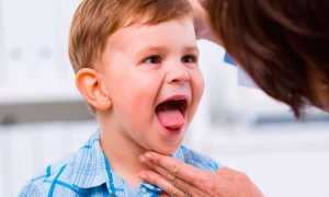 Почему желтый налет на языке у ребенка