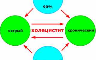 Воспаление желчного пузыря у взрослых