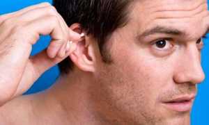 Как лечить перхоть в ушной раковине