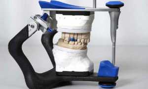 Как работать с гипсом в стоматологии