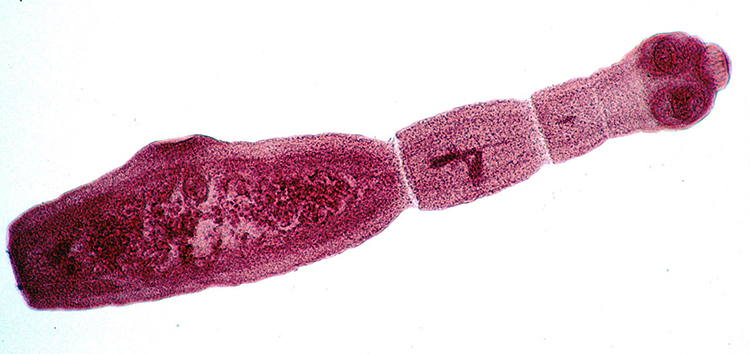 Echinococcus multilocularis