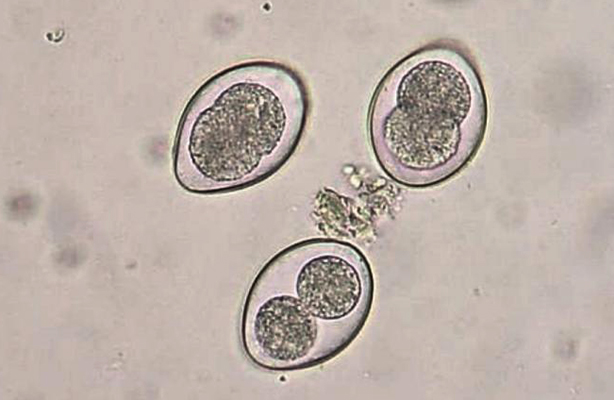 coccidia