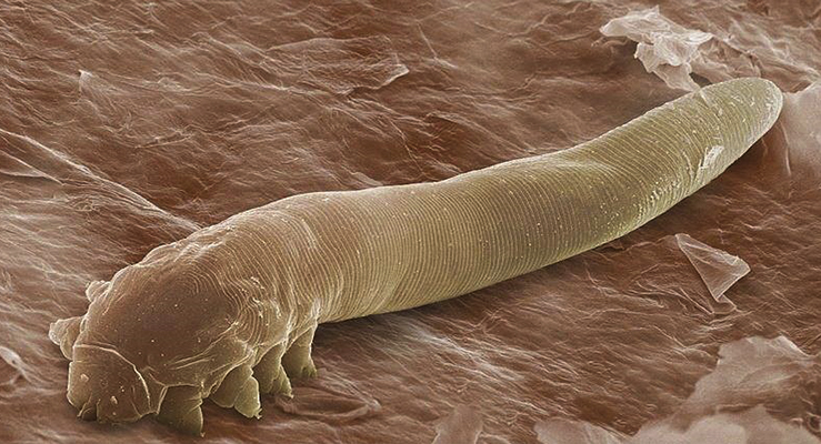 Demodex follikulorum