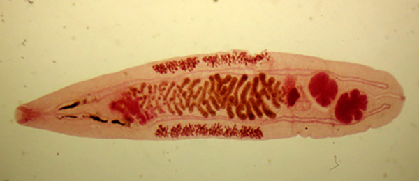 Opisthorchis felineus