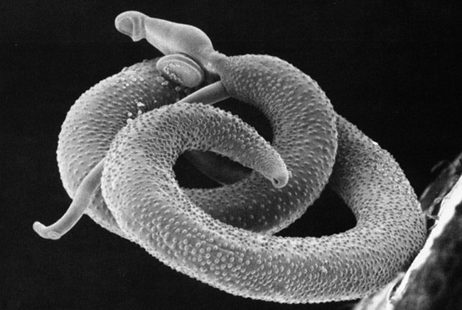 Schistosoma mansoni