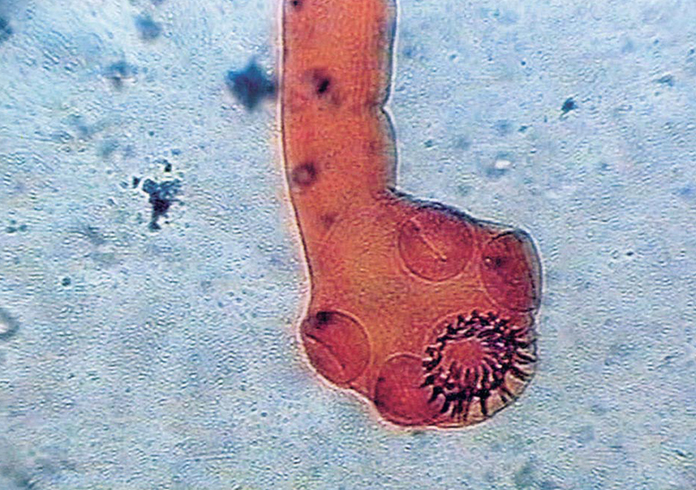 Taenia solium