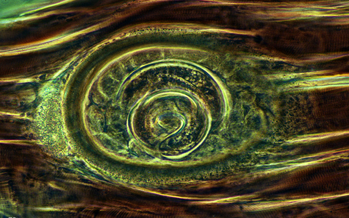 Trichinella spiralis