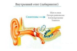 Доктор Комаровский о лечении и профилактике отита у детей