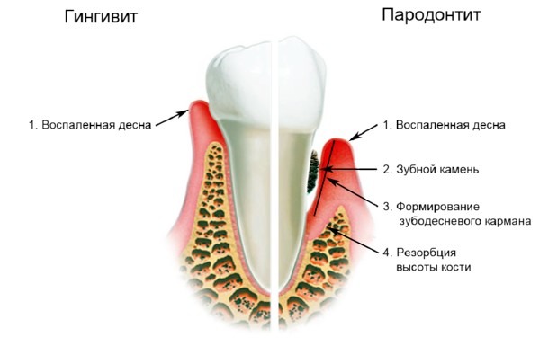 Комок в груди что это может быть