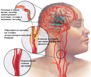 Кружится голова и закладывает уши причины, диагностика и лечение