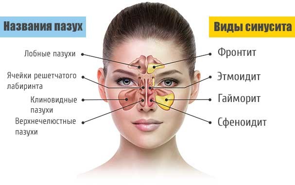 Почему текут сопли ручьем и чем их лечить