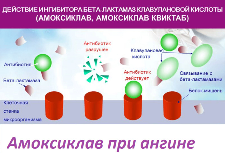 Может ли быть ангина без температуры