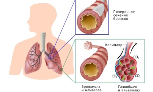 Как вывести мокроту у грудничка