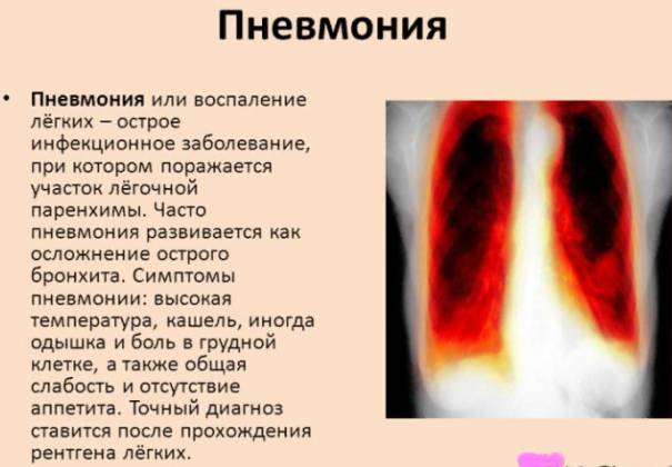 Мокрота курильщика и после отказа от курения. Сколько отходит и как избавиться