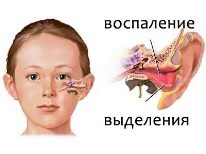 Характеристика лекарства от насморка Ринофлуимуцил и лекарственные аналоги