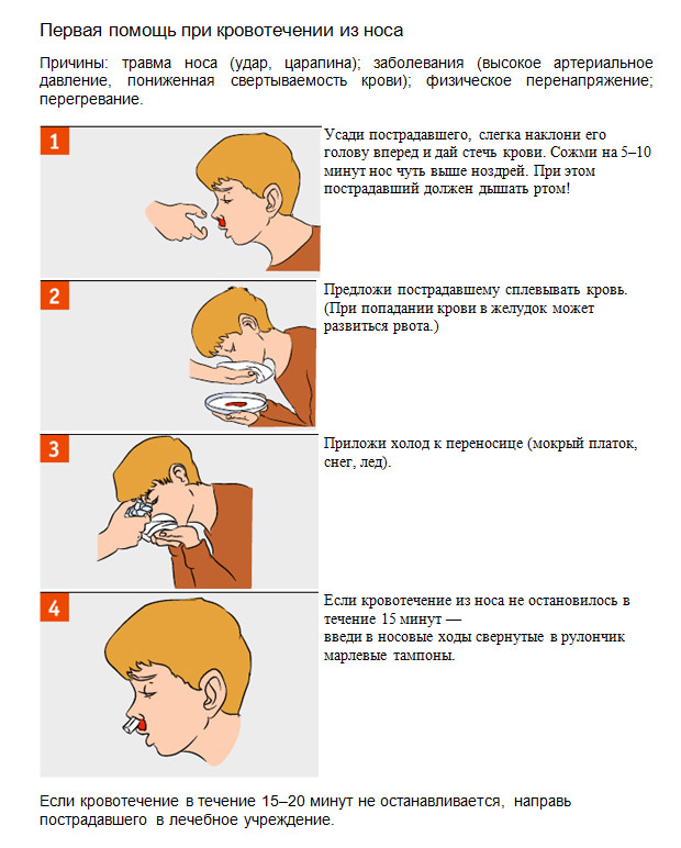 Причины носового кровотечения