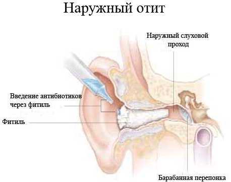 Как понять по симптомам, что у грудничка болит ухо