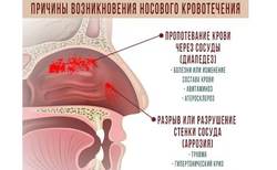 Сильная головная боль отдающая в нос