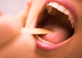 Лечение воспаления миндалин в горле и где расположены гланды у взрослых
