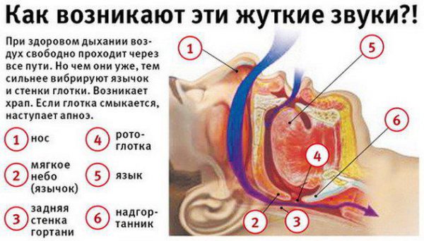 Причины и лечение храпа у мужчин