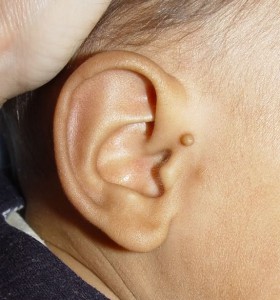 Что такое козелок уха и какую функцию он выполняет