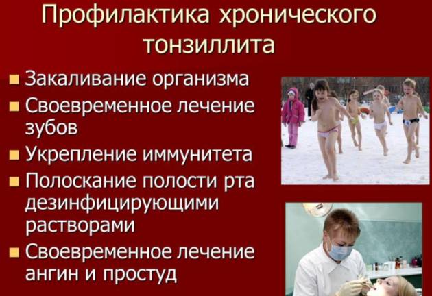 Опасности хронического тонзиллита: основные симптомы и причины развития заболевания