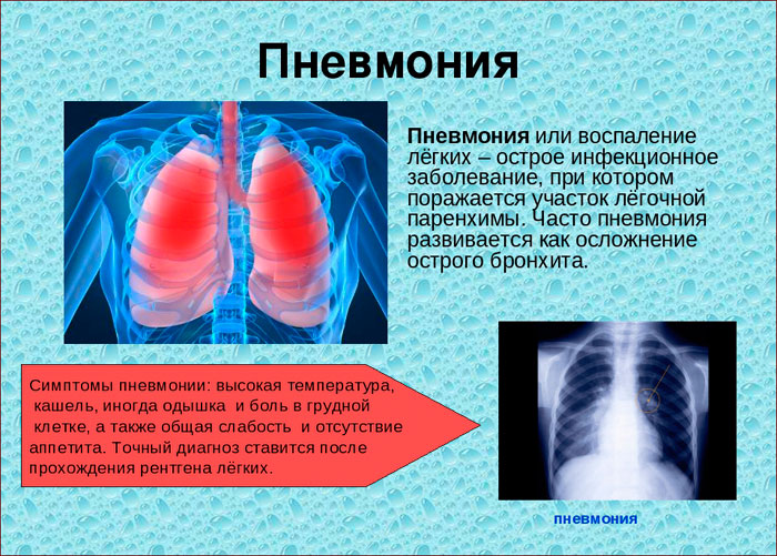 Причины и симптомы болезней легких у человека