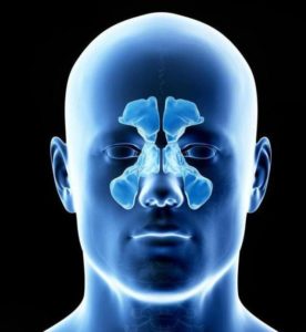 Как проводится МРТ пазух носа и что показывает
