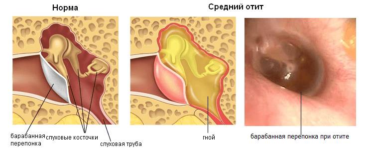 Что такое козелок уха и какую функцию он выполняет