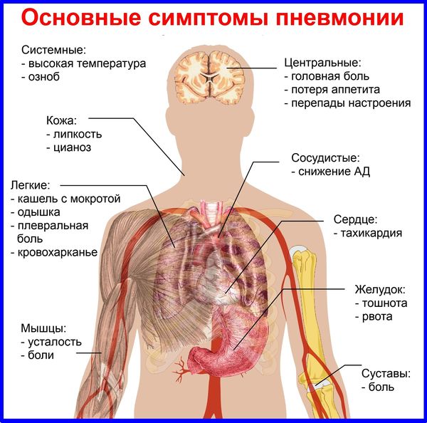 Почему не проходит кашель и что делать